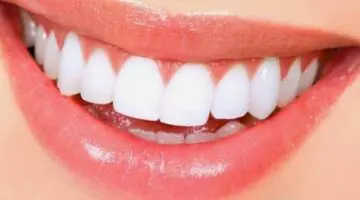 استعدي لابتسامة ساحرة: تعرّفي على وصفة تبييض الأسنان بالنشا