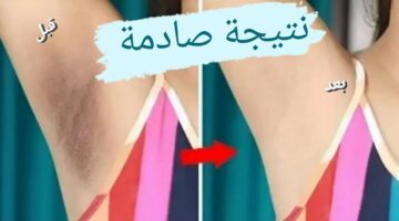 هيبقى زي القشطة.. هاتي لمونة وشوية كركم وتخلصي من سواد الإبط نهائيا في 10دقائق فقط