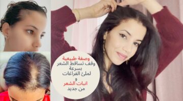 ندمت إني معرفتهاش من زمان.. خلطة سحرية لملء فراغات الشعر والحصول على شعر كثيف وطويل بأقل تكاليف.. مش هتصدقي النتيجة