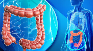 كيف أنظف القولون والامعاء من السموم والغازات والبراز المتحجر