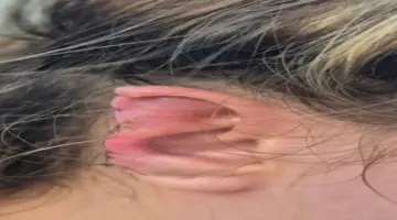 برازيلي يعض أذن زوجته بسبب «التأخر في الحمام»