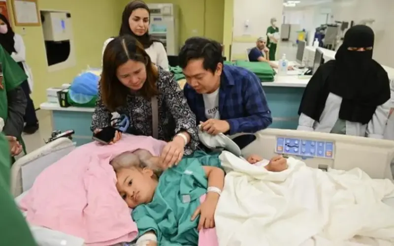 صحيفة المرصد – “الربيعة” يكشف تفاصيل عملية فصل التوأم الملتصق الفلبيني “كليا وموريس آن”.. ويُبيّن نسبة الخطر!